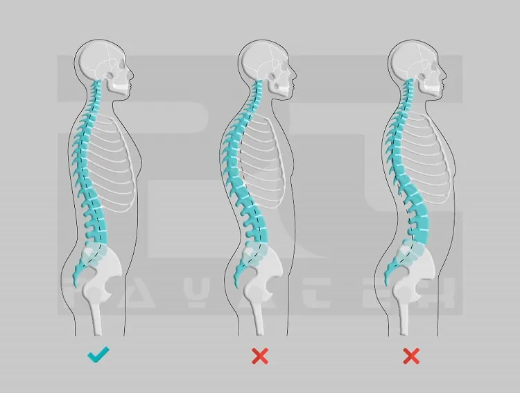 1. اصلاح پاسچر یا حالت بدن